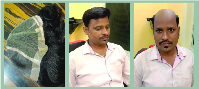 Hair weaving service in Howrah