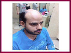 Hair weaving service in Howrah