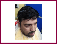 wig manufacturer in kolkata