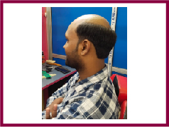 Hair weaving service in Howrah