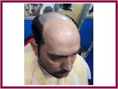 hair wig in Howrah